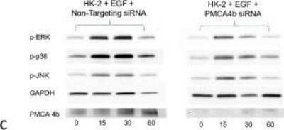 Western Blot: PMCA4 Antibody (2G8) [H00000493-M07]