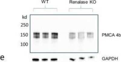 Western Blot: PMCA4 Antibody (2G8) [H00000493-M07]