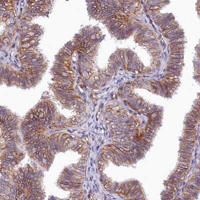 Immunohistochemistry-Paraffin: PMCA4 Antibody [NBP2-31984]
