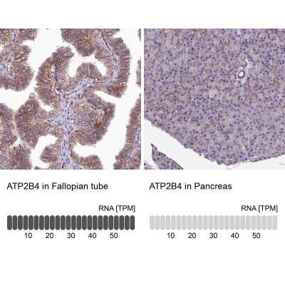 Immunohistochemistry-Paraffin: PMCA4 Antibody [NBP2-31984]