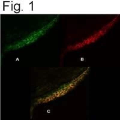 Immunocytochemistry/ Immunofluorescence: PMCA4 Antibody (JA9) [NB300-569]