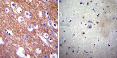 Immunohistochemistry-Paraffin: PMCA4 Antibody (JA9) [NB300-569]