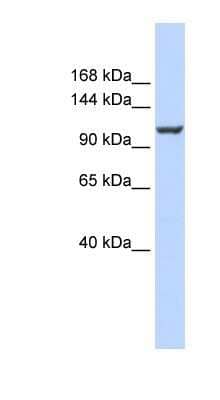 Western Blot: PMCA4 Antibody [NBP1-59481]