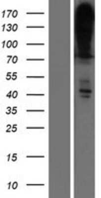 Western Blot: PMCA4 Overexpression Lysate [NBP2-10766]