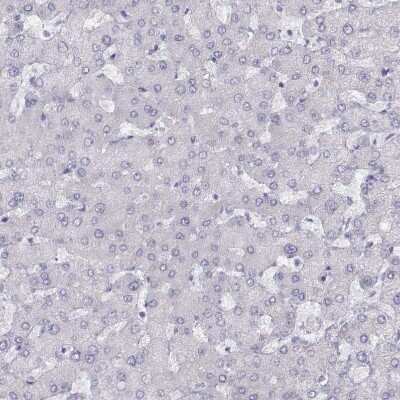Immunohistochemistry-Paraffin: PMCH Antibody [NBP2-13780]