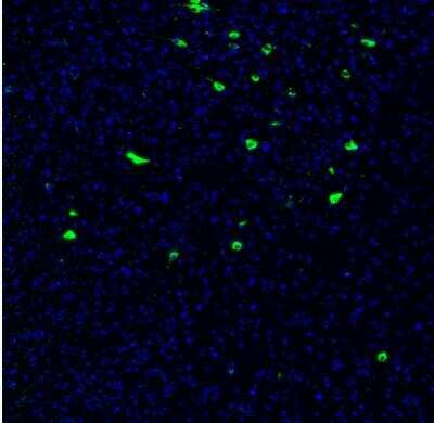 Immunohistochemistry: PMCH Antibody [NBP2-57697]