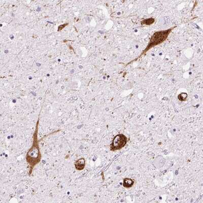 Immunohistochemistry-Paraffin: PMCH Antibody [NBP2-13780]