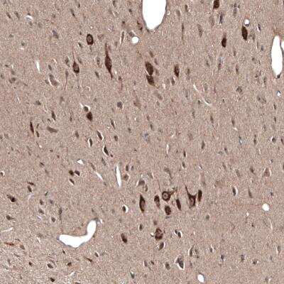 Immunohistochemistry-Paraffin: PMCH Antibody [NBP2-13780]
