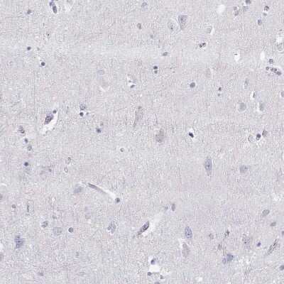 Immunohistochemistry-Paraffin: PMCH Antibody [NBP2-13780]