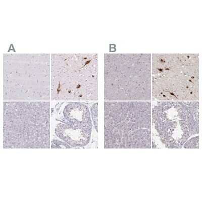 Immunohistochemistry-Paraffin: PMCH Antibody [NBP2-13780]