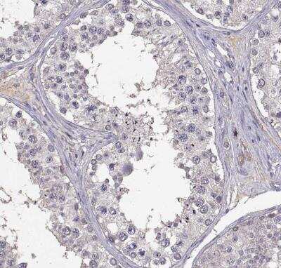 Immunohistochemistry-Paraffin: PMCH Antibody [NBP2-57697]