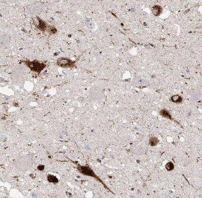 Immunohistochemistry-Paraffin: PMCH Antibody [NBP2-57697]