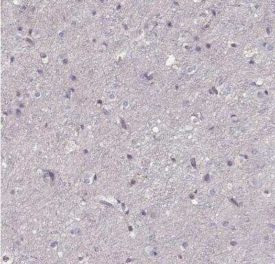 Immunohistochemistry-Paraffin: PMCH Antibody [NBP2-57697]