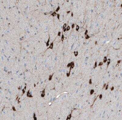 Immunohistochemistry-Paraffin: PMCH Antibody [NBP2-57697]