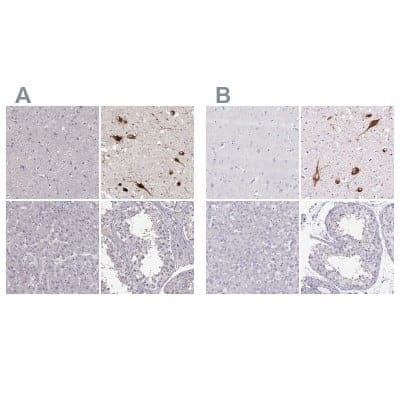 Immunohistochemistry-Paraffin: PMCH Antibody [NBP2-57697]