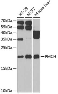 Western Blot: PMCH AntibodyBSA Free [NBP2-94063]