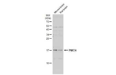 Western Blot: PMCH Antibody [NBP3-12955]