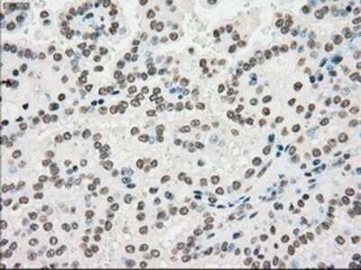 Immunohistochemistry-Paraffin: PMEL17/SILV Antibody (OTI10E5) [NBP1-47974]