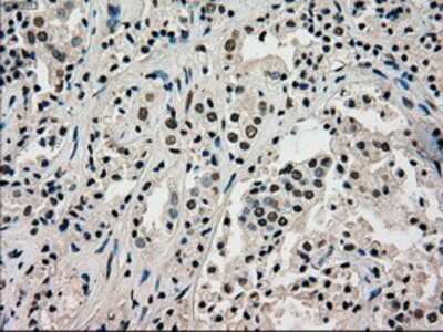 Immunohistochemistry-Paraffin: PMEL17/SILV Antibody (OTI10E5) [NBP1-47974]