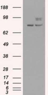 Western Blot: PMEL17/SILV Antibody (OTI10E5) [NBP1-47974]