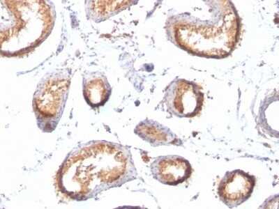 Immunohistochemistry-Paraffin: PMEL17/SILV Antibody (HMB45 + PMEL/783) - Azide and BSA Free [NBP2-47780]