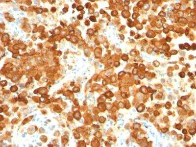 Immunohistochemistry-Paraffin: PMEL17/SILV Antibody (HMB45 + PMEL/783) - IHC-Prediluted [NBP2-48342]