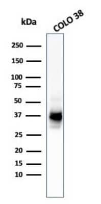 Western Blot: PMEL17/SILV Antibody (HMB45 + PMEL/783) [NBP2-44523]