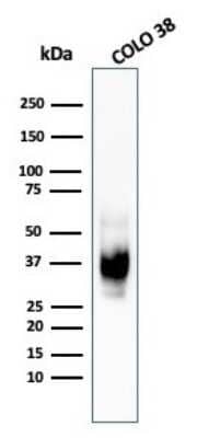 Western Blot: PMEL17/SILV Antibody (HMB45)Azide and BSA Free [NBP2-34638]