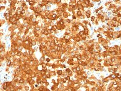 Immunohistochemistry-Paraffin: PMEL17/SILV Antibody (HMB45) - IHC-Prediluted [NBP2-48316]
