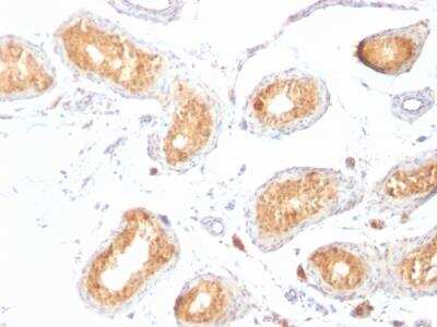 Immunohistochemistry-Paraffin: PMEL17/SILV Antibody (HMB45) - IHC-Prediluted [NBP2-48316]