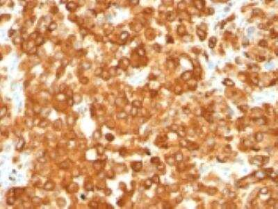 Immunohistochemistry-Paraffin: PMEL17/SILV Antibody (HMB45) [NBP2-44520]