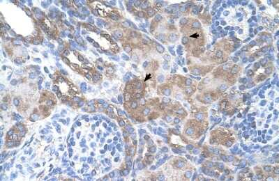 Immunohistochemistry: PMEL17/SILV Antibody [NBP1-69571]