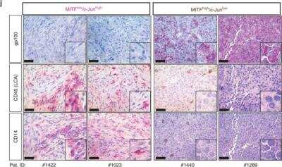 Immunohistochemistry: PMEL17/SILV Antibody [NBP1-69571]