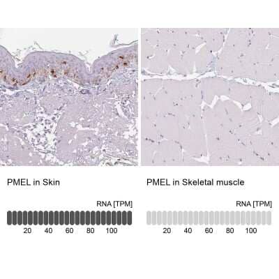 Immunohistochemistry-Paraffin: PMEL17/SILV Antibody [NBP2-38185]