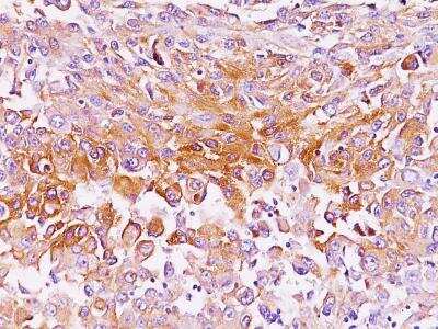 Immunohistochemistry-Paraffin: PMEL17/SILV Antibody (NKI-beteb) [NBP2-29407]