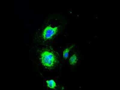 Immunocytochemistry/ Immunofluorescence: PMEL17/SILV Antibody (OTI10E5) - Azide and BSA Free [NBP2-73479]