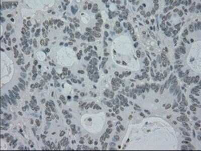 Immunohistochemistry: PMEL17/SILV Antibody (OTI10E5) - Azide and BSA Free [NBP2-73479]