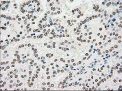 Immunohistochemistry: PMEL17/SILV Antibody (OTI10E5) - Azide and BSA Free [NBP2-73479]