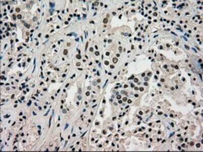 Immunohistochemistry: PMEL17/SILV Antibody (OTI10E5) - Azide and BSA Free [NBP2-73479]