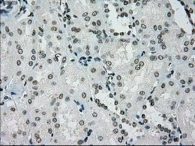 Immunohistochemistry: PMEL17/SILV Antibody (OTI10E5) - Azide and BSA Free [NBP2-73479]