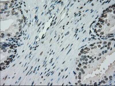 Immunohistochemistry: PMEL17/SILV Antibody (OTI10E5) - Azide and BSA Free [NBP2-73479]
