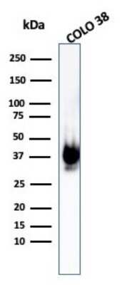 Western Blot: PMEL17/SILV Antibody (PMEL/1825R)Azide and BSA Free [NBP2-54454]