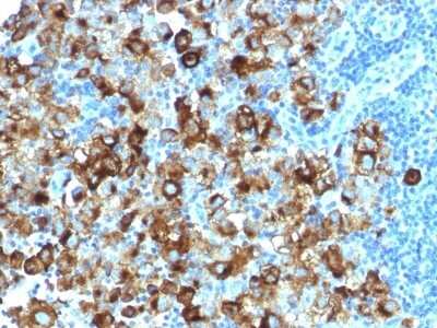 Immunohistochemistry-Paraffin: PMEL17/SILV Antibody (PMEL/1825R) [NBP2-53180]