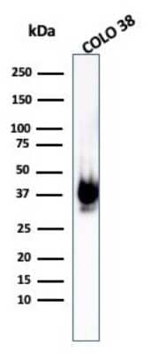 Western Blot: PMEL17/SILV Antibody (PMEL/1825R) [NBP2-53180]