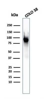 Western Blot: PMEL17/SILV Antibody (PMEL/2037) [NBP3-07782]