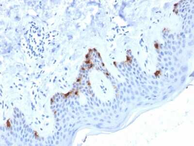 Immunohistochemistry-Paraffin: PMEL17/SILV Antibody (PMEL/2038) [NBP3-07599]