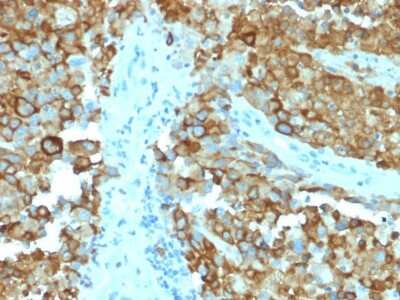 Immunohistochemistry-Paraffin: PMEL17/SILV Antibody (PMEL/2038) - Azide and BSA Free [NBP3-08517]
