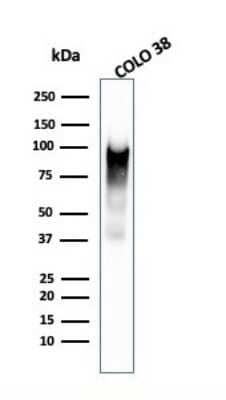 Western Blot: PMEL17/SILV Antibody (PMEL/2038) [NBP3-07599]