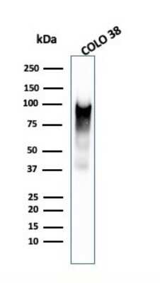 Western Blot: PMEL17/SILV Antibody (PMEL/2038)Azide and BSA Free [NBP3-08517]