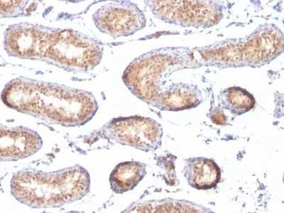 Immunohistochemistry-Paraffin: PMEL17/SILV Antibody (PMEL/783) - Azide and BSA Free [NBP2-47779]